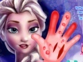 Gioco Frozen. Hand surgery