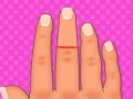 Gioco Finger surgery