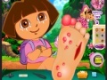 Gioco Dora Foot Injuries
