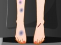Gioco Sara Feet Accident