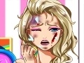 Gioco Elsa Face Surgery