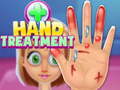 Gioco Hand Treatment