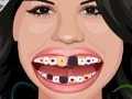 Gioco Selena Gomez Perfect Teeth 