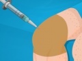 Gioco Operate Now: Knee Surgery